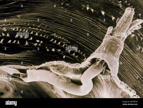 Micrographie Lectronique Balayage D Un Spiracle Ant Rieure Ou Tube