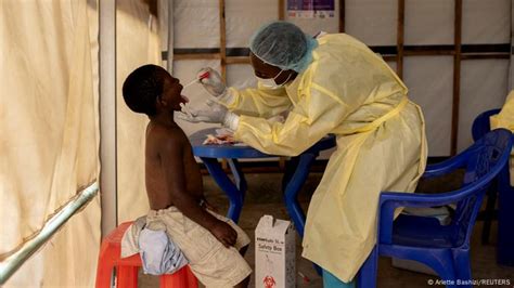 Suécia registra 1º caso de mpox fora da África após novo surto que fez