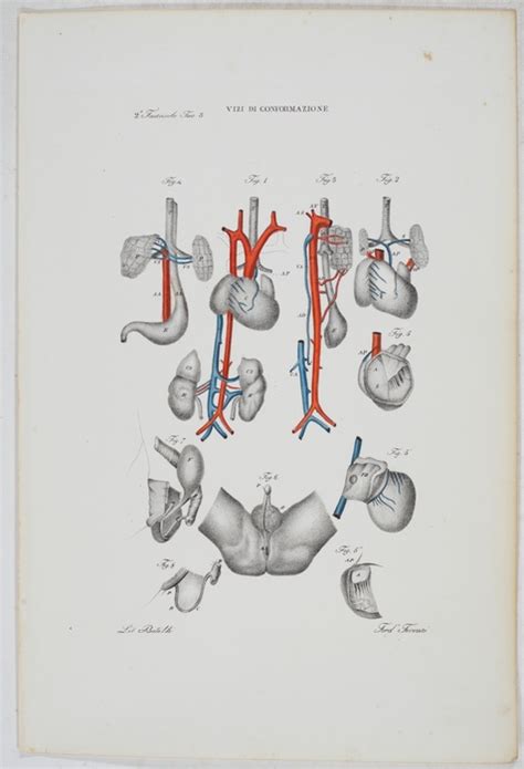 Malattie Del Feto Tafeln Aus Atlante Generale Della Anatomia