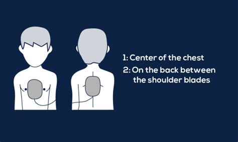 Guide to AED Pad Placement - MDPRO USA