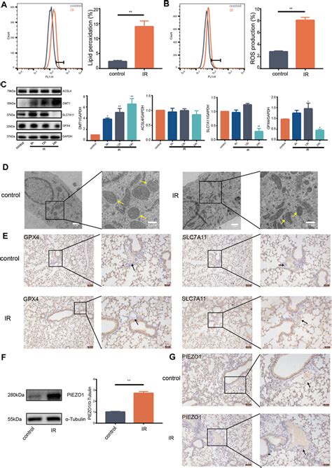 Frontiers Piezo Ion Channel Mediates Ionizing Radiation Induced