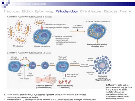 Pathogenesis of tuberculosis