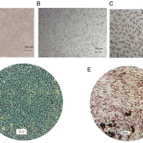 Bm Mscs Characterization A Bm Mscs Were Adherent To The Culture Download Scientific Diagram