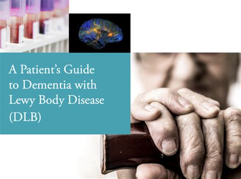 A Patients Guide To Dementia With Lewy Body Disease Ucsf Brain