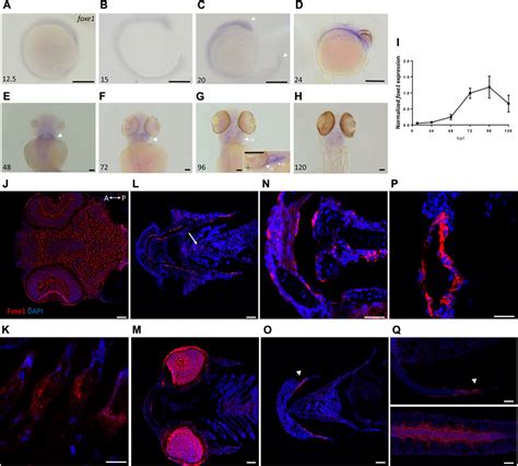 Frontiers Disruption Of The Foxe Gene In Zebrafish Reveals Conserved