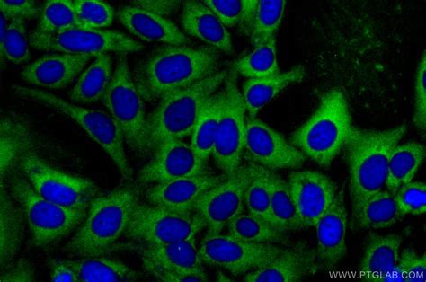 KPNA3 Antibody 28050 1 AP Proteintech