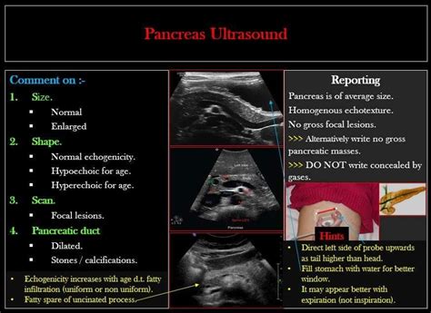 Brilliant How To Write Abdominal Ultrasound Report Example Of Writing ...