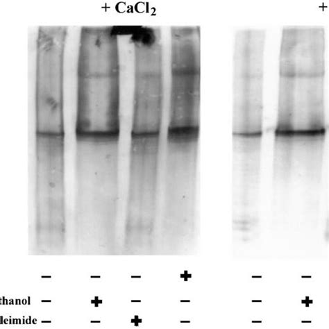 Nondenaturing Gel Electrophoresis Of Hrc Zn Affinity Purified Hrc 11 Download Scientific