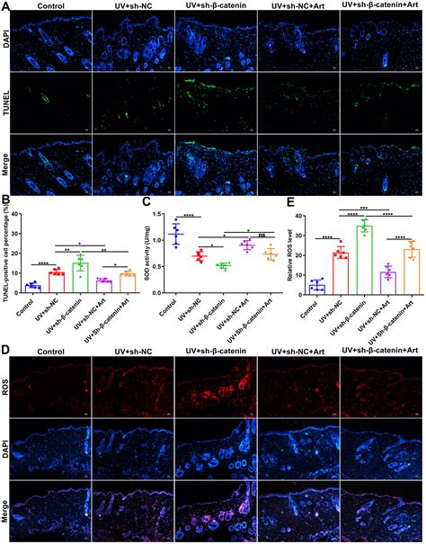 Artesunate Treatment Ameliorates Ultraviolet Irradiation Driven Skin Photoaging Via Increasing β