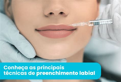 Conheça As Principais Técnicas De Preenchimento Labial Blog Odonto