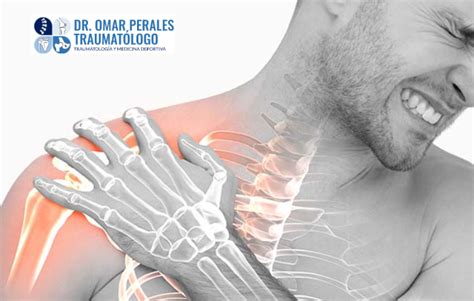 HOMBRO CONGELADO Dr Perales traumatólogo