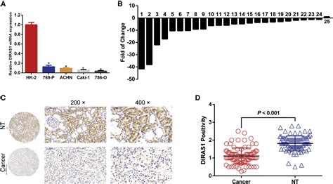 RNAa And Vector Mediated Overexpression Of DIRAS1 Suppresses Tumor