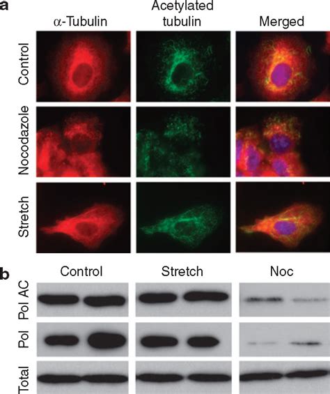 Microtubule Acetylation Through Hdac Inhibition Results In Increased