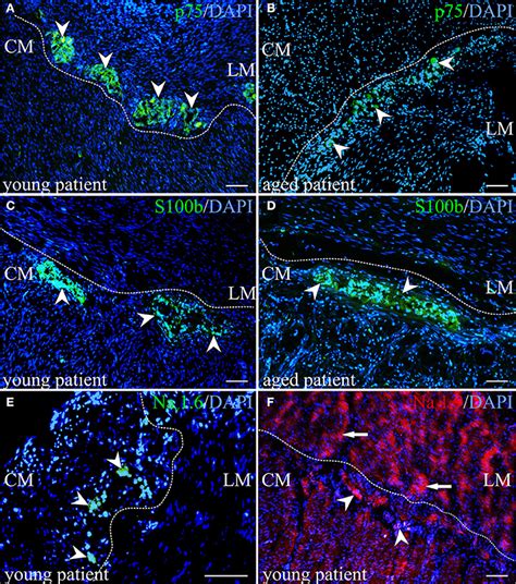 Immunohistochemical Visualization Of Neurotrophin Receptor P P