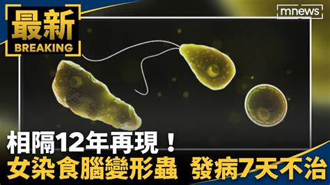 相隔12年再現！ 女感染「食腦變形蟲」發病7天不治｜鏡新聞 Youtube