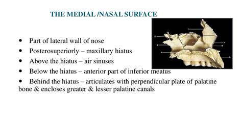 Fracture maxilla