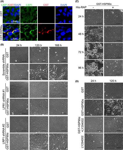 Extracellular HSP90 Promotes Differentiation Of Lens Epithelial Cells