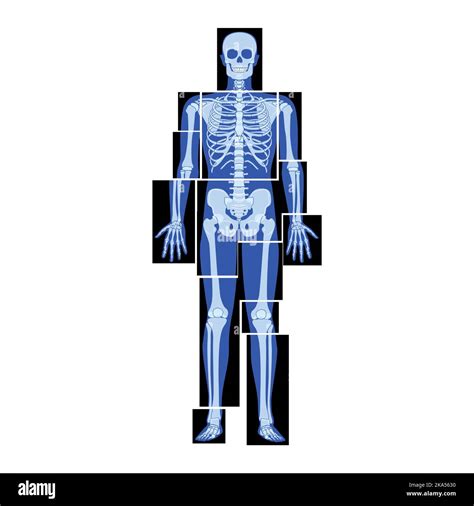 Radiografía Del Pie De Frente Fotografías E Imágenes De Alta Resolución Alamy