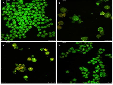 Confocal Images Of HCT116 Cells Showing The Morphology Of A Non Treated