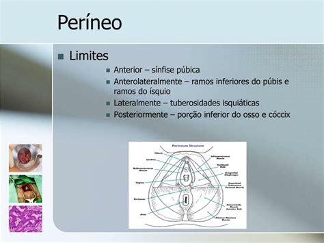 Ppt Patologia Perianal Powerpoint Presentation Free Download Id 829116