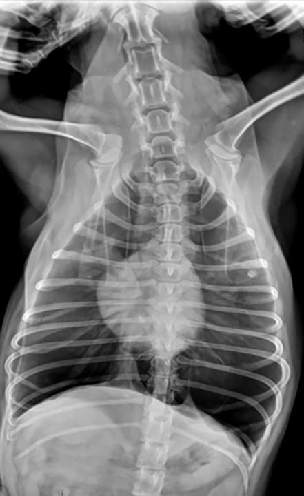 Thoracic Spine Radiographs