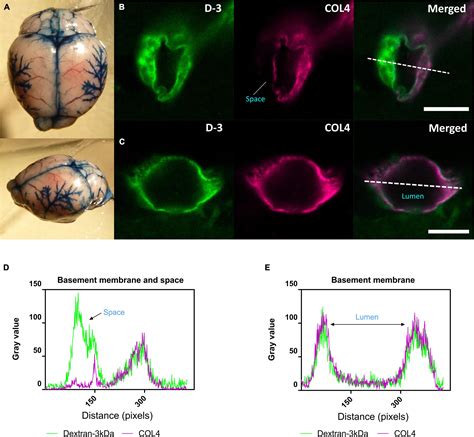 Frontiers Impaired Glymphatic Function And Pulsation Alterations In A