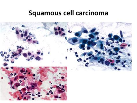 Atlas Of Exfoliative Cytology Commonwealth Fund Publications 4
