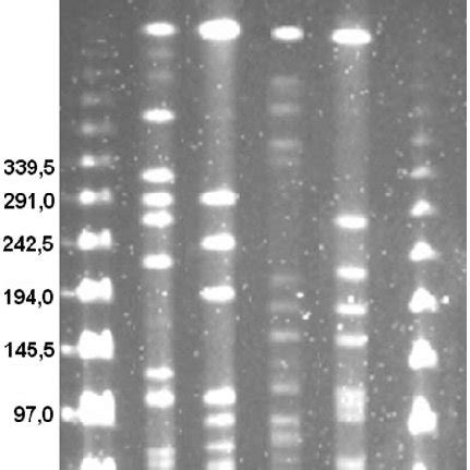 Pulsed Field Gel Electrophoresis Patterns Of SmaIdigested Genomic DNA