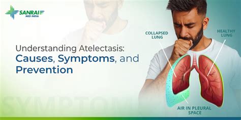 Understanding Atelectasis Causes Symptoms Prevention Sanrai Med