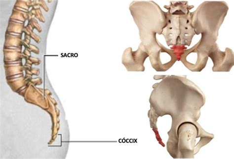 Coccidínia (dor no cóccix): Sintomas, Diagnóstico e Tratamento