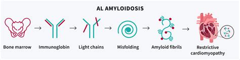 Cardiac Amyloidosis - University of Ottawa Heart Institute