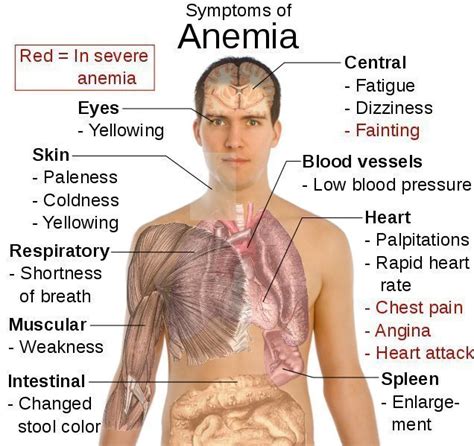 Symptoms of Anemia – Medical Symptoms Guide