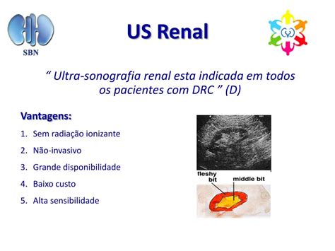 Ppt Diagn Stico E Estadiamento Da Doen A Renal Cr Nica Powerpoint