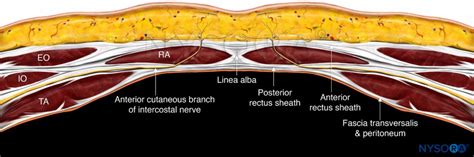 Rectus Sheath Block Anatomy