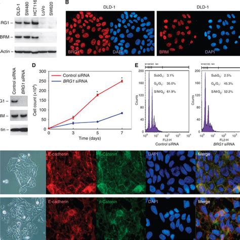 The SWI SNF Chromatin Remodelling BRG1 And BRM Expression In Human CRC