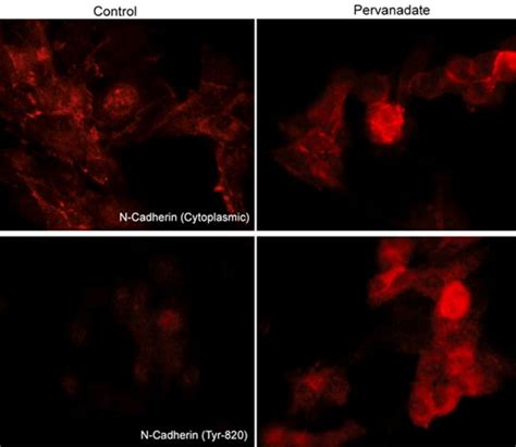 Ecm Bioscience N Cadherin Phospho Regulation Antibody Sampler Kit Ecm