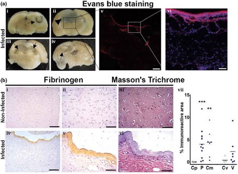 Evans Blue Extravasation And Fibrinogen Panel A Evans Blue Staining