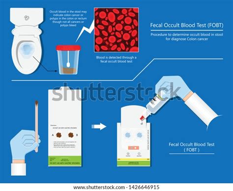 What Is Fecal Occult Blood Test Everything You Need To 60 Off