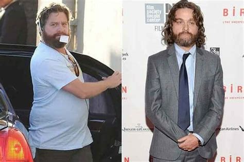 Zachary Galifianakis Weight Loss Journey The Full Story