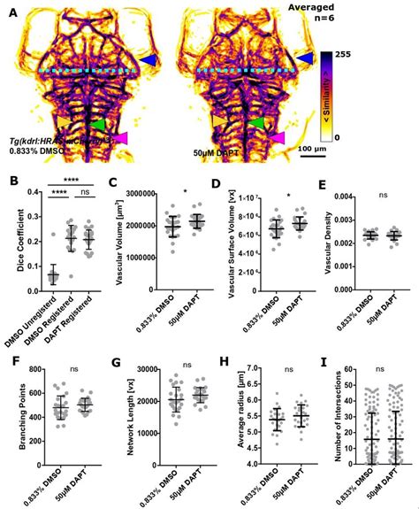 Fig S The Impact Of Notch Inhibition On Vascular Topology A Mips Of