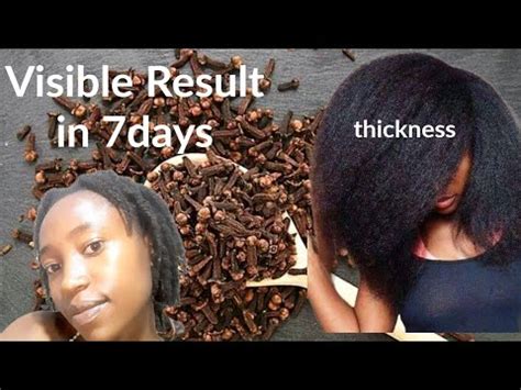 HOW TO USE CLOVES PROPERLY FOR UNSTOPPABLE HAIR GROWTH I Grow My Hair