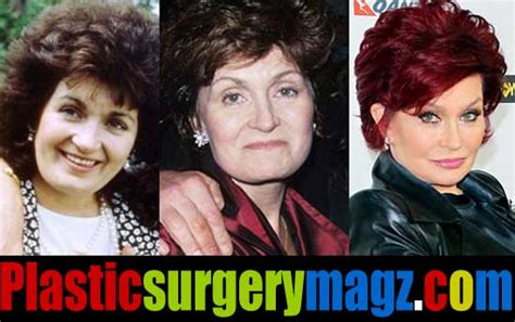 Sharon Osbourne Plastic Surgery Before and After Pictures | | Plastic ...