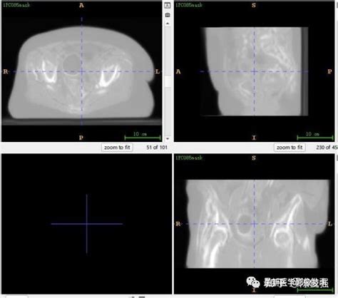 Synthrad Ct