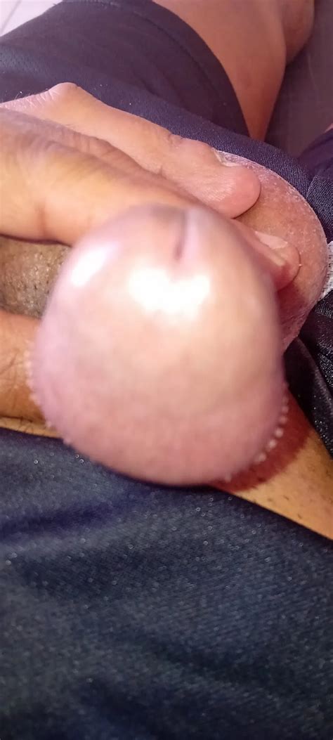 Gland Nude Pics Xhamster