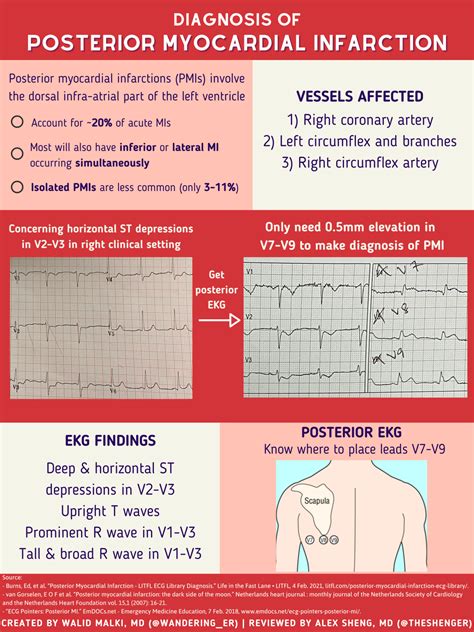 emDOCs.net – Emergency Medicine EducationPosterior MI_Infographic - emDOCs.net - Emergency ...