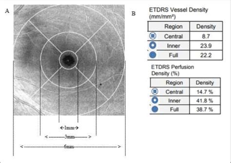 A Etdrs Grid Centred On The Macula B Cirrus Metrix Showing Central