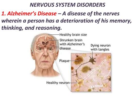 Disorder Of The Nervous System Ppt