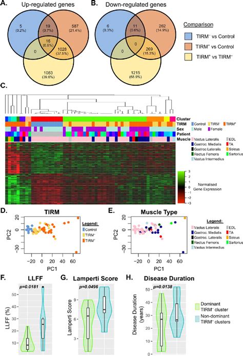 Differential Gene Expression Analysis Of Muscle Biopsies Reveals Download Scientific Diagram