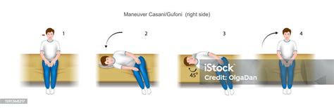 Casani Gufoni Maneuver Right Side Stock Illustration - Download Image ...