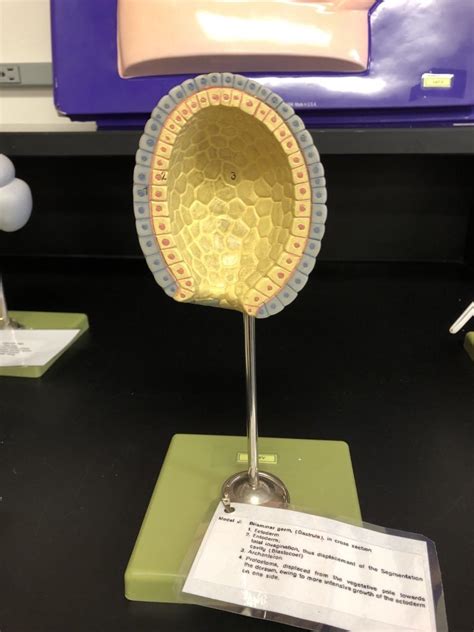 gastrulation Diagram | Quizlet